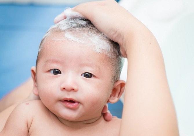 5 Tips Atasi Ketombe Pada Kulit Bayi