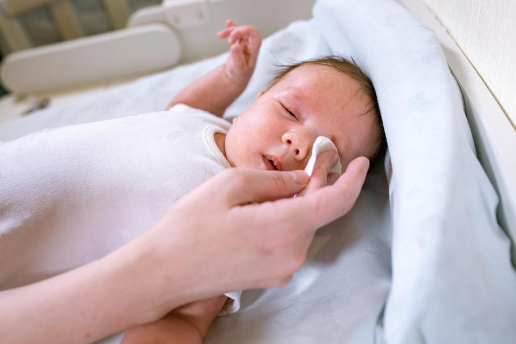 Moms, Pahami Cara Sederhana Ini untuk Mengatasi Mata Bayi Belekan