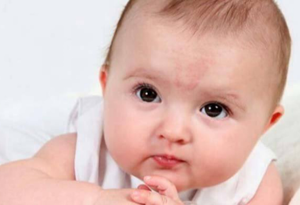 8 Cara Mengatasi Kulit Bayi Mengelupas