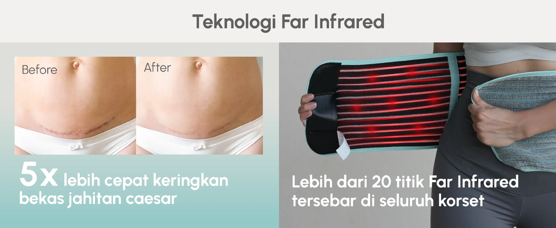 MOOIMOM Korset Hamil, Pasca-melahirkan, Caesar 2in1 Premium Bamboo Corset description image