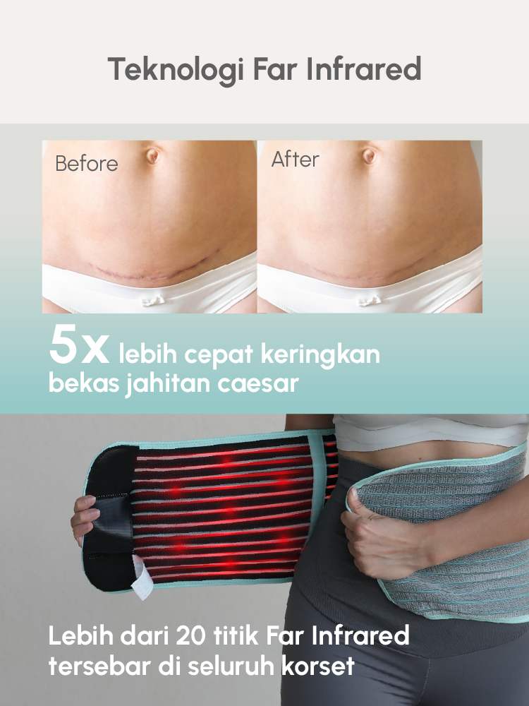 MOOIMOM Korset Hamil, Pasca-melahirkan, Caesar 2in1 Premium Bamboo Corset description image